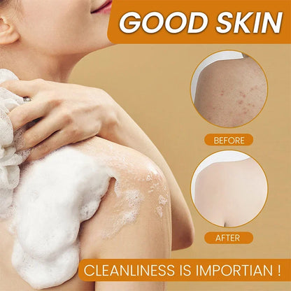 RisenSkinDetox - Turmeric Kojic Acid Soap - Brighten & Glow Your Skin Naturally