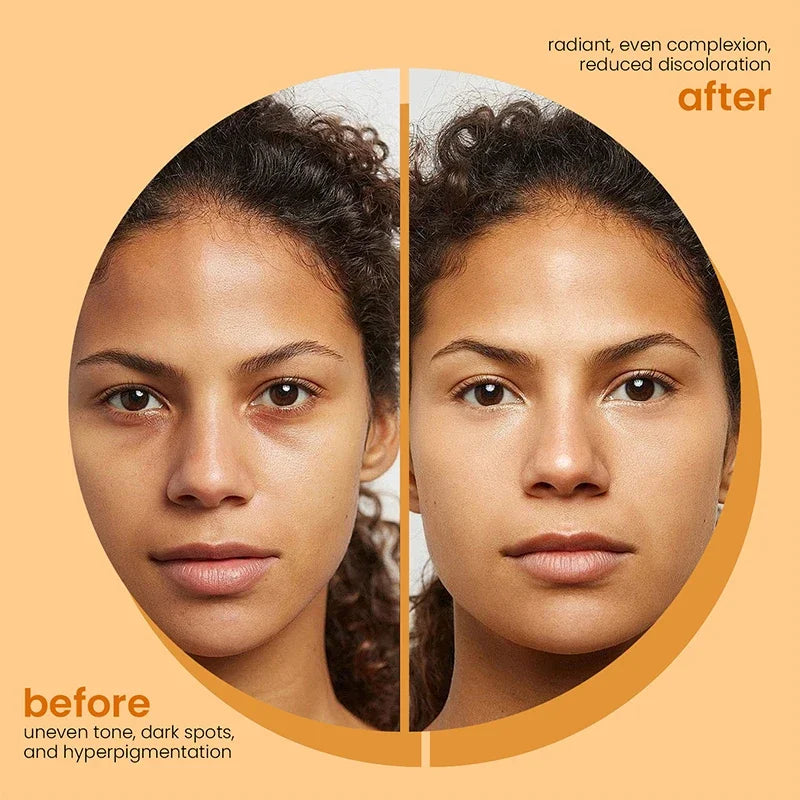 RisenSkinDetox - Turmeric Kojic Acid Soap - Brighten & Glow Your Skin Naturally