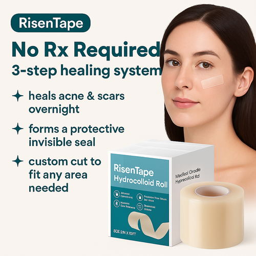 Risentape - Hydrocolloid Magic Roll for Acne & Healing Scars Overnight